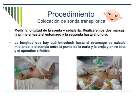 Sondas En Pacientes Pediatricos Ppt