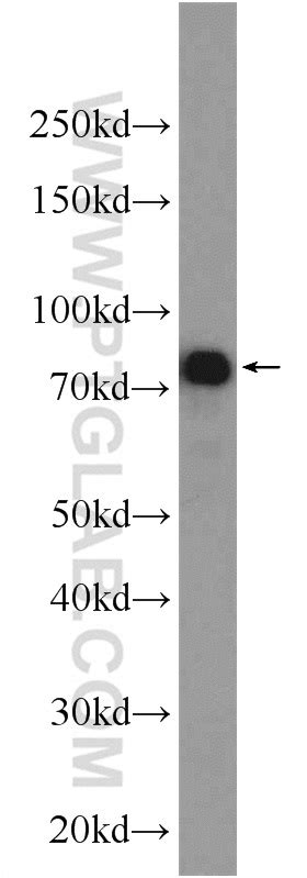 IRF3 antibody 11312 1 AP Proteintech 武汉三鹰生物技术有限公司