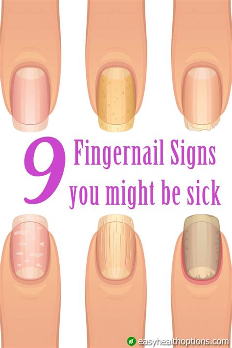 Easy Health Options® 9 Fingernail Signs You Might Be Sick Health