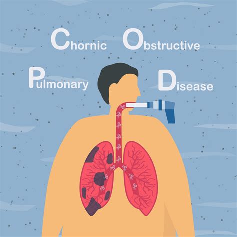 Chronic Obstructive Pulmonary Disease Design 1212712 Vector Art At Vecteezy