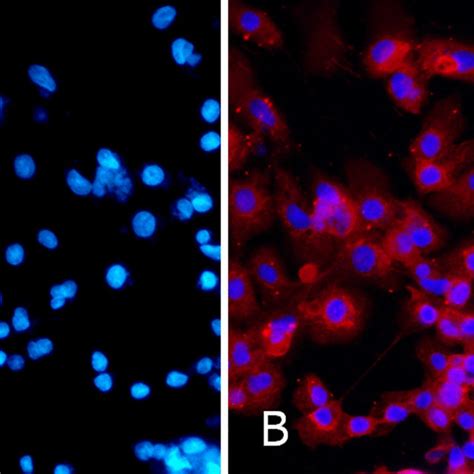 Immunofluorescence Detection Of Hcmv Pp65 Antigens In Evt A Control