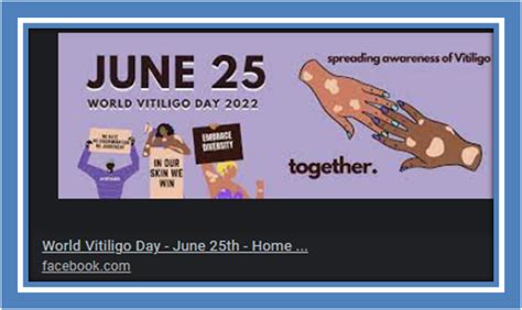 World Vitiligo Day 2022 Awareness Acceptance And Inclusion Are Helpful