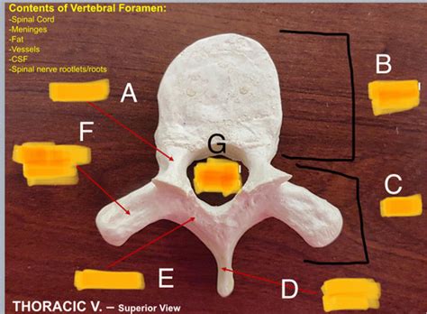 Thoracic Vertebrae Flashcards | Quizlet