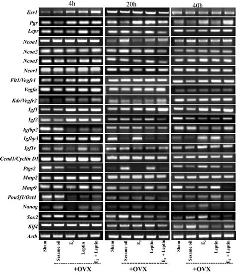 Semi Quantitative Rt Pcr Revealed Gene Expression In Uterine Tissue