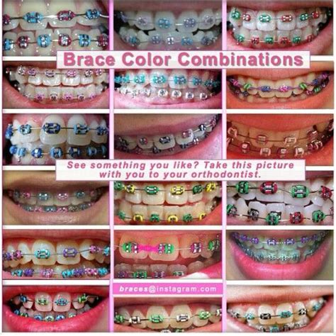 Braces Colors That Look Good Together