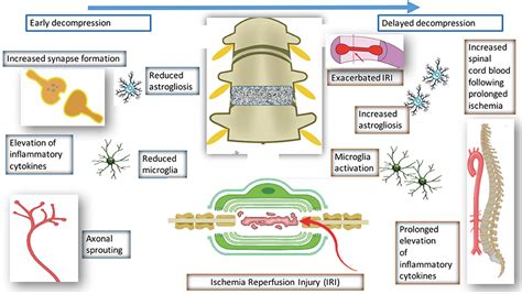 Frontiers The Pathophysiology Of Degenerative Cervical Myelopathy And