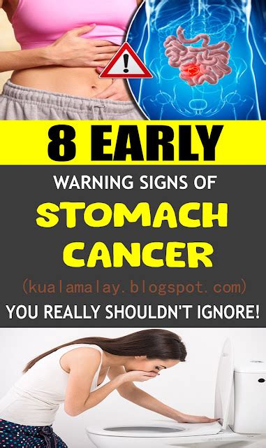 8 Early Warning Signs of Stomach Cancer (You Really Shouldn t Ignore!)