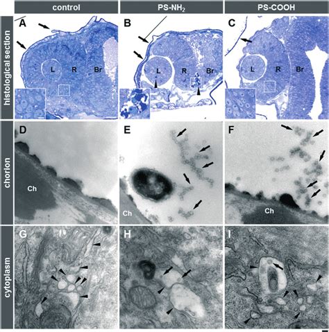 Histological And Ultrastructural Analysis To Assess Adverse Effects And