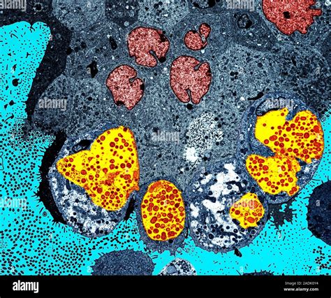 Chlamydia Infection Coloured Transmission Electron Micrograph Tem Of