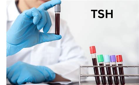 O Que E Exame De Tsh - TSH Alto ou Baixo: Alterações e Importância Clínica