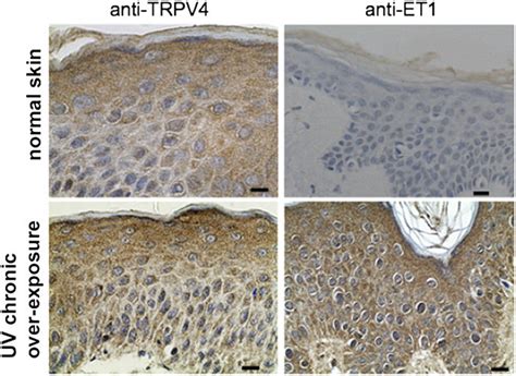 Fig S Exemplars Of Human Chronic Uv Overexposure Upper Normal