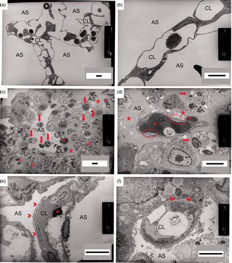 Ultrastructural Imaging Of Distal Lung Parenchyma During Pa Induced