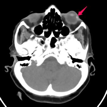 Image Radiopaedia Org