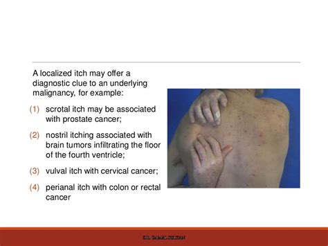 Cutaneous Manifestations Of Internal Malignancy And Paraneoplastic Sy