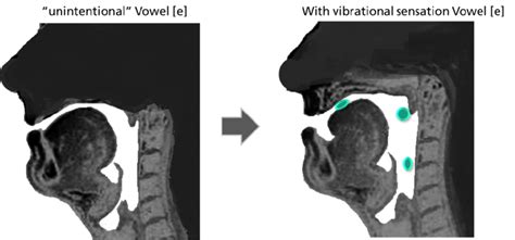 Sagittal MRI sections of the vocal tract during phonation (Martin... | Download Scientific Diagram