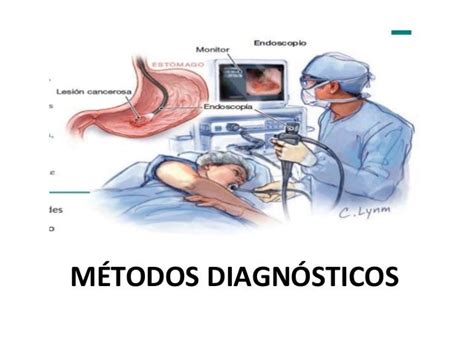 Cancer Gastrico