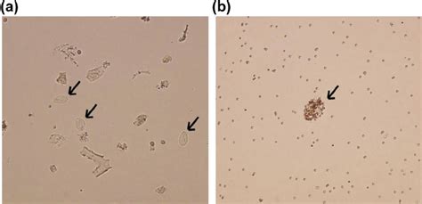 A Three Giardia Cysts Arrow After Sucrose Gradient Fl Otation Some Download Scientific