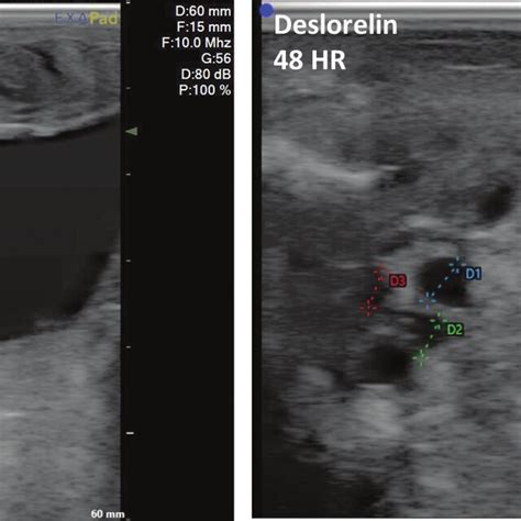 Representative Images From Serial Transrectal Ultrasonography Of Does Download Scientific