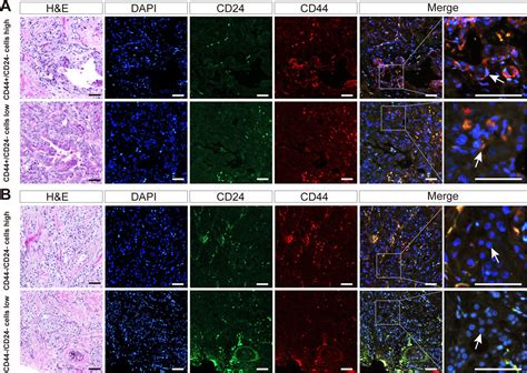 Figures And Data In Association Of Human Breast Cancer Cd44 Cd24