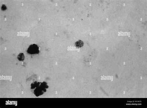 Photomicrograph of the malaria parasite Plasmodium malariae in ...