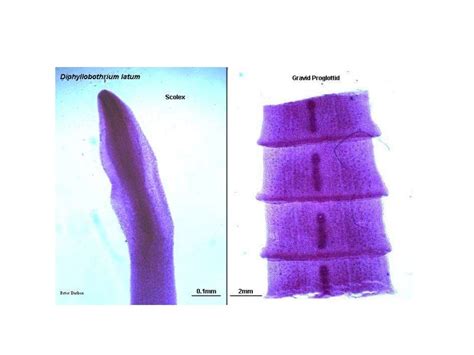 Diphyllobothrium Latum