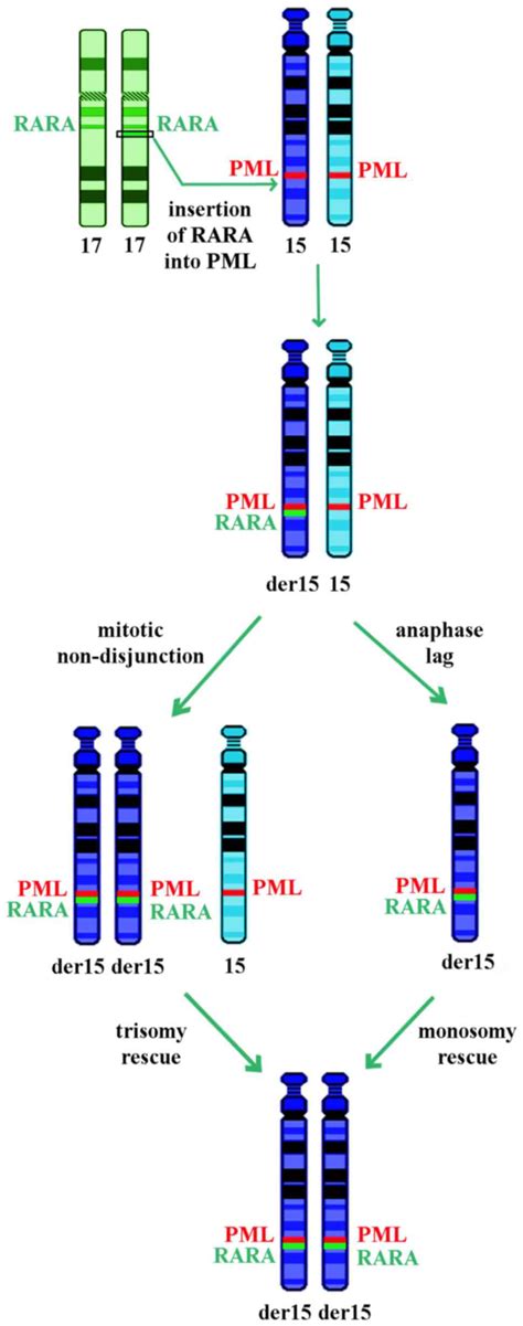 Leukemia Chromosome 15