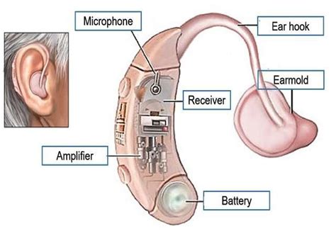 Parts Of A Hearing Aid Diagram