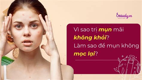 Vì sao trị mụn mãi không khỏi Làm sao để mụn không mọc lại Beaudy vn