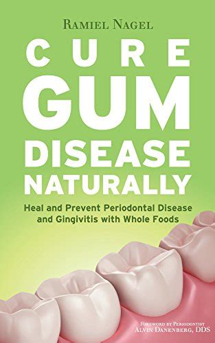 Cure Gum Disease Naturally Heal And Prevent Periodontal Disease And Gingivitis With Whole Foods