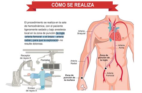 Cardiac Catheterization A Journey To The Heart Time News