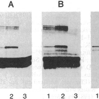 Sds Page And Immunoblot Analysis Of Purified Fibrinogen Samples Of