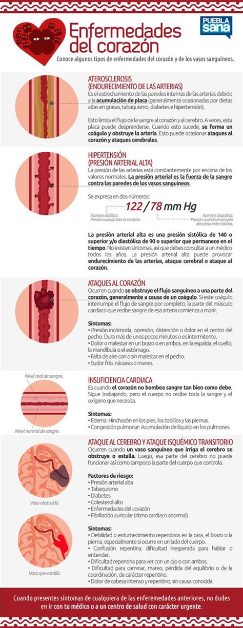 Enfermedades Del Corazón Invdes