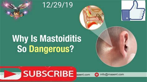 Mastoiditis A Thorough Review Definition And Explanation Bavaji