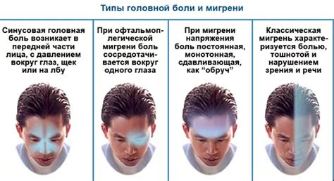 Что помогает при головной боли: Таблетки от головной боли: ТОП 14 ...