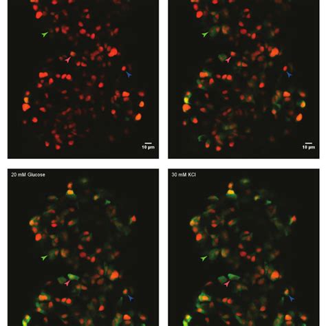 Ex Vivo Live Imaging Of Calcium Influx Using Gcamp S In Zebrafish