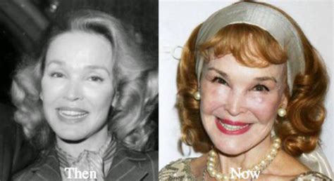 Kathryn Crosby Plastic Surgery Before And After Photos Latest Plastic Surgery Gossip And News