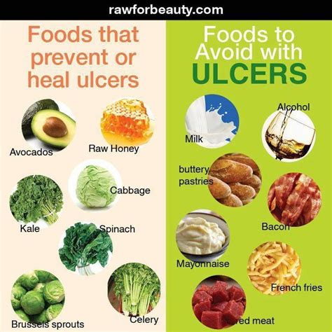 20 best Stomach ulcer diets, ext. images on Pinterest | Ulcer diet ...