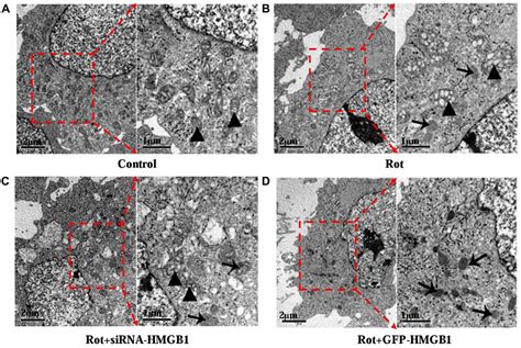 Frontiers Hmgb1 Mediates Autophagy Dysfunction Via Perturbing Beclin1