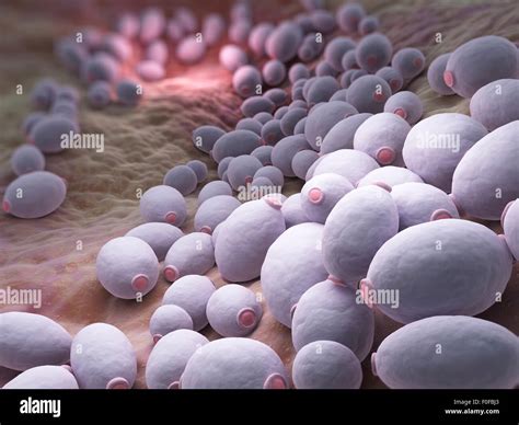 Candidiasis Hi Res Stock Photography And Images Alamy