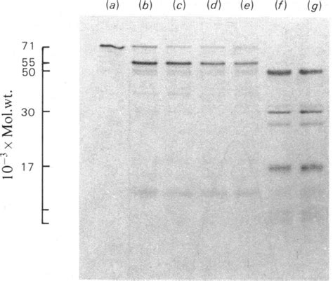 Analysis By Sdspolyacrylamide Gel Electrophoresis Ofconvicilin And Download Scientific Diagram