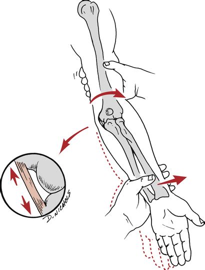 Orthopedic Management Of The Elbow Musculoskeletal Key