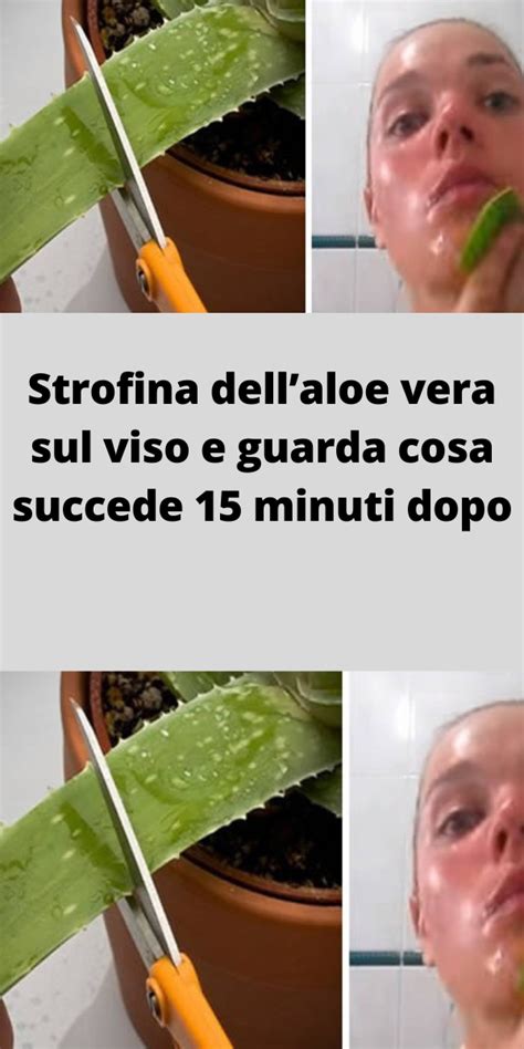 Strofina Dellaloe Vera Sul Viso E Guarda Cosa Succede 15 Minuti Dopo