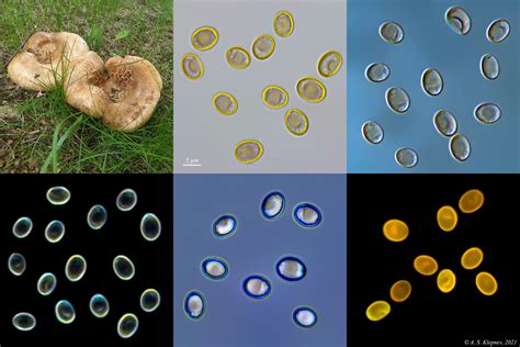 Fungus Spores Under A Microscope Part 1 Brightfield Dic Darkfield