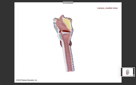 Lab Medial View Of Larynx Ch 22 Respiratory System Diagram Quizlet