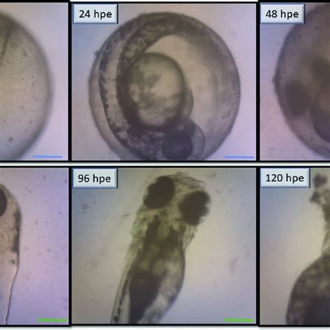 Images Of Normal Zebrafish Embryogenesis Showing Stages Of Development