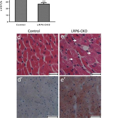 Cardiomyocyte Specific Deletion Of LRP6 Causes Cardiac Dysfunction And