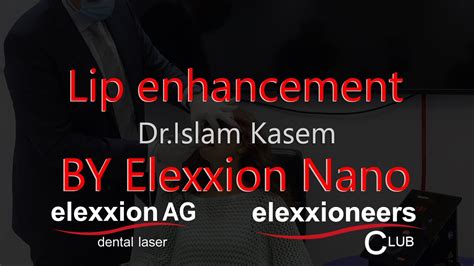 Lip Enhancement By Elexxion Nano Diode Laser Dr Islam Kassem Youtube