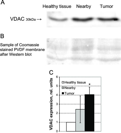 A Western Blot Analysis Of The Level Of Voltage Dependent Anion