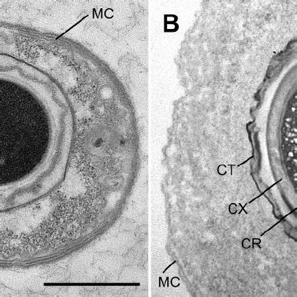 Ultrastructure of intracellular offspring of Epulopiscium -like... | Download Scientific Diagram