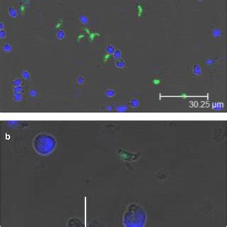 Clsm Picture Of Infected Pbmc Culture H P I Stained With Dapi Blue